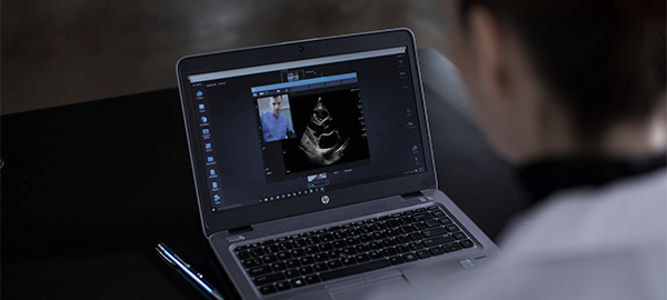 ноутбук с изображением сонограммы