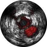 Изображение бифуркации