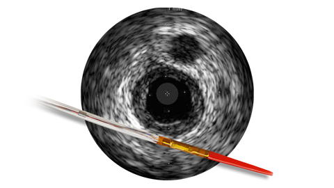 Vision&nbsp;PV (0,014&nbsp;дюйма) RX