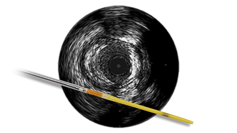 Visions&nbsp;PV (0,035&nbsp;дюйма)