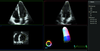 Изображение эскиза DQA QuickGuide