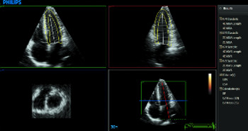 Изображение эскиза DQ QuickGuide