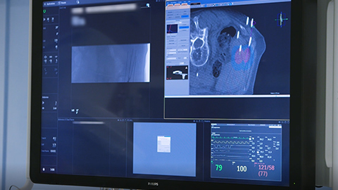 Philips Azurion 7 М20 с потолочным креплением, отзывы клиентов из больницы St. Antonius, г. Ньювегейн, Нидерланды