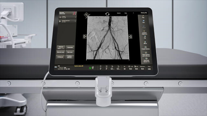 TSM изображение