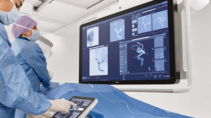 Лечение аневризмы головного мозга