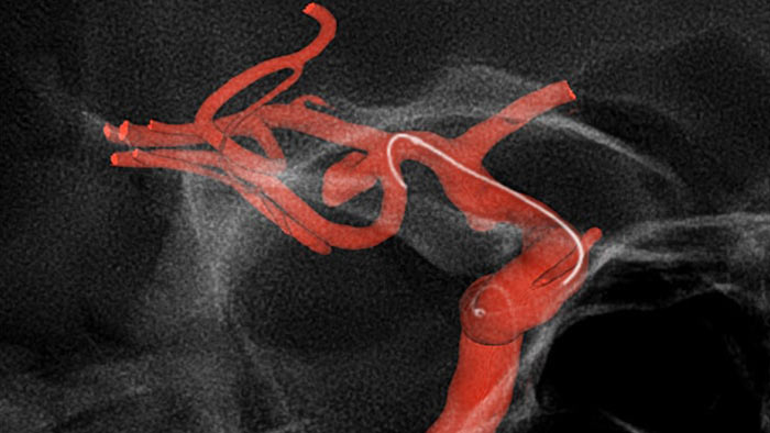 Улучшенная визуализация с&nbsp;SmartCT&nbsp;Roadmap