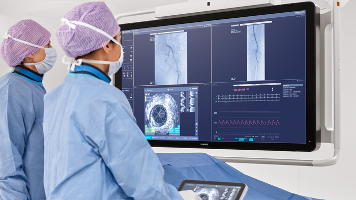 Лечение АВМ