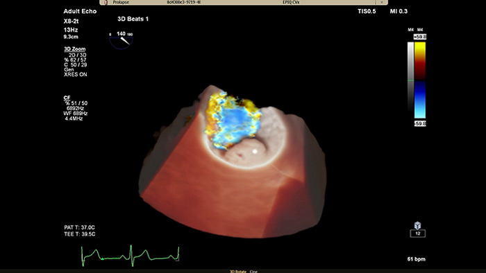 EPIQ CVx&nbsp;&mdash; TrueVue Color