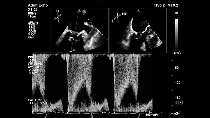 EPIQ CVx&nbsp;&mdash; xPlane Doppler
