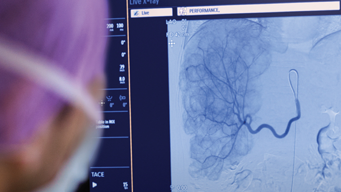 Tech maximizer для рентгеновских исследований