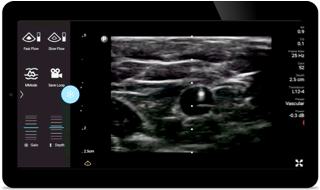 Уменьшение частоты осложнений