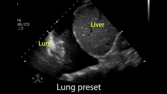 Пациент получает лечение