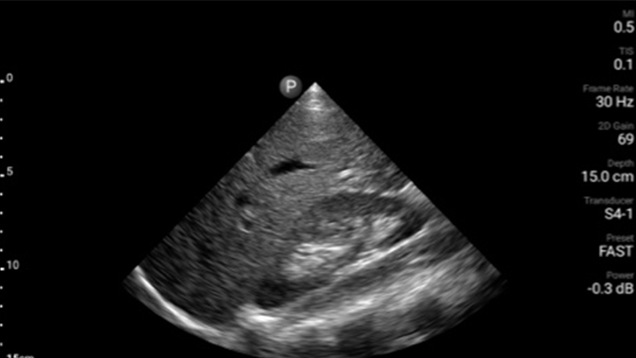 Значок почки и печени