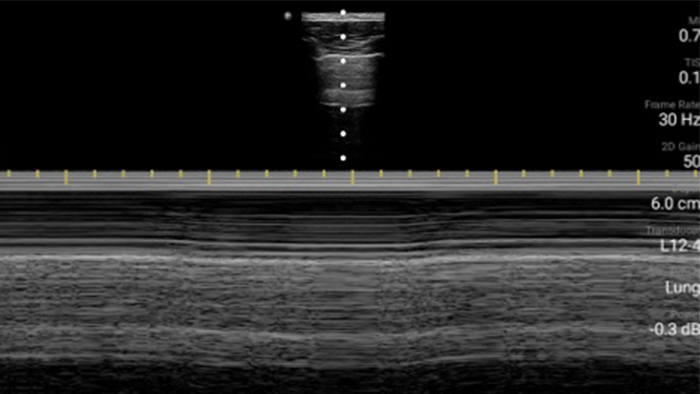 Третий значок легких