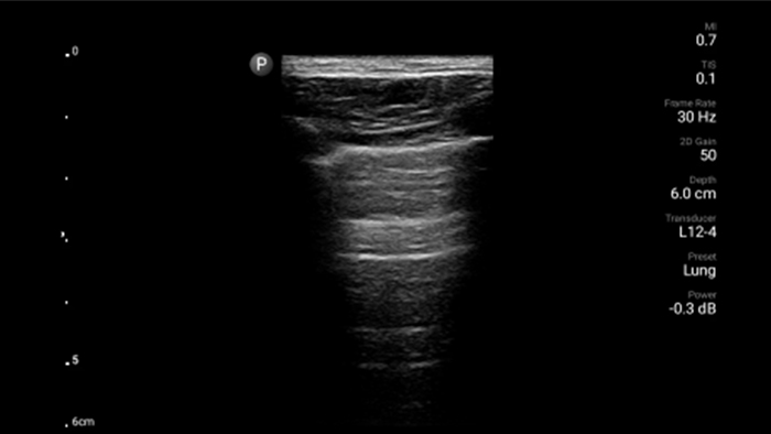 Последний значок видео о легких