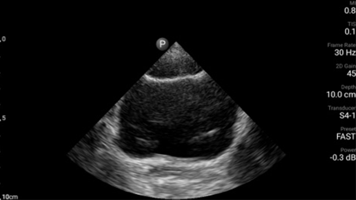 Значок мочевого пузыря