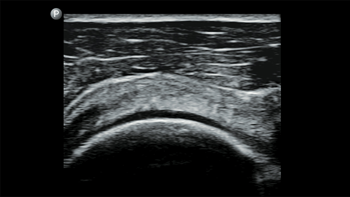 Значок плеча