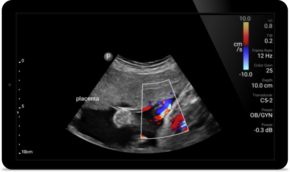 Пример изображения Padstatic