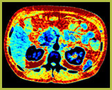 Эффективная Z-карта