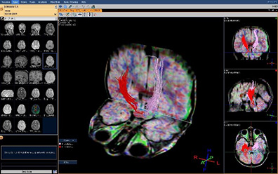 изображение мозга (download .jpg)