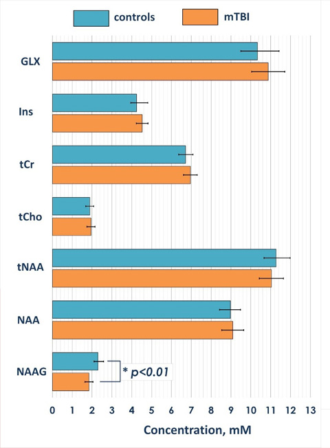 график из нескольких гистограмм
