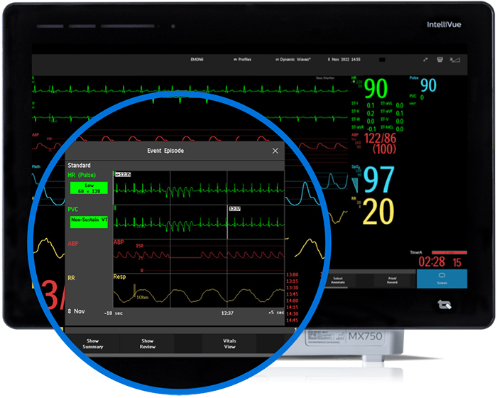 Монитор усовершенствованной функции наблюдения событий, версия для настольного ПК
