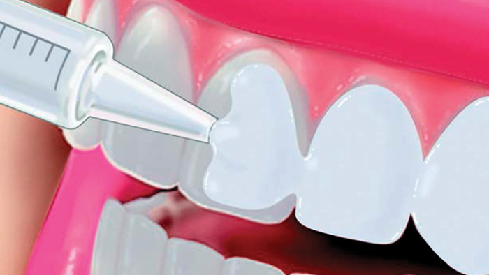  отбеливание зубов