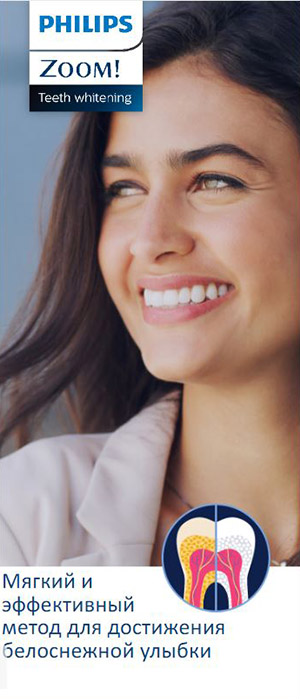 Брошюра для пациента: Отбеливание